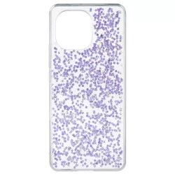 Funda Glitter Premium para Xiaomi Mi 11